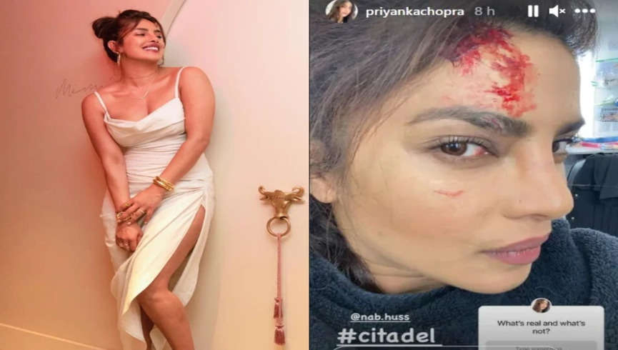 Priyanka Chopra ने खून पसीने से की थी Citadel की शूटिंग, वीडियो साझा कर दिखाईं चोटें